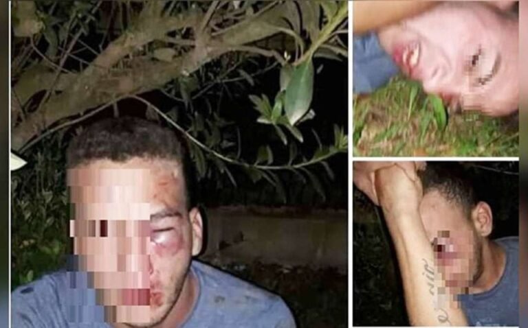 Dan golpiza a hombre de 25 años tras pactar cita con una niña de 12 años en Argentina