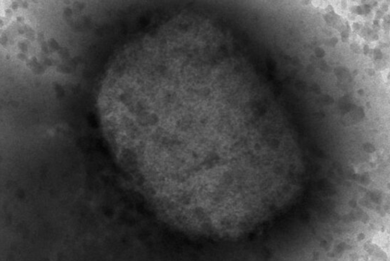 Detectan un caso de viruela del mono en Kanasín